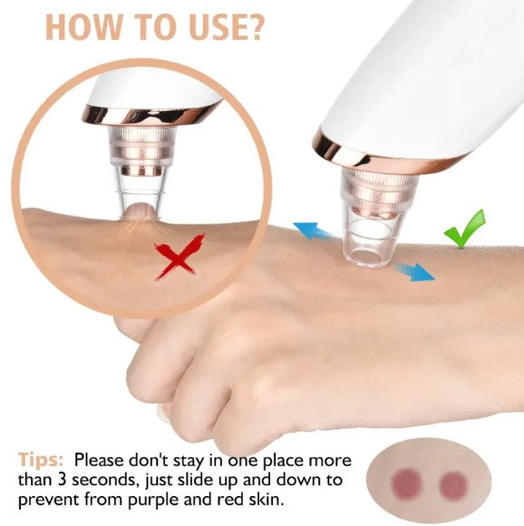 Vioré™ PoreLift Pro